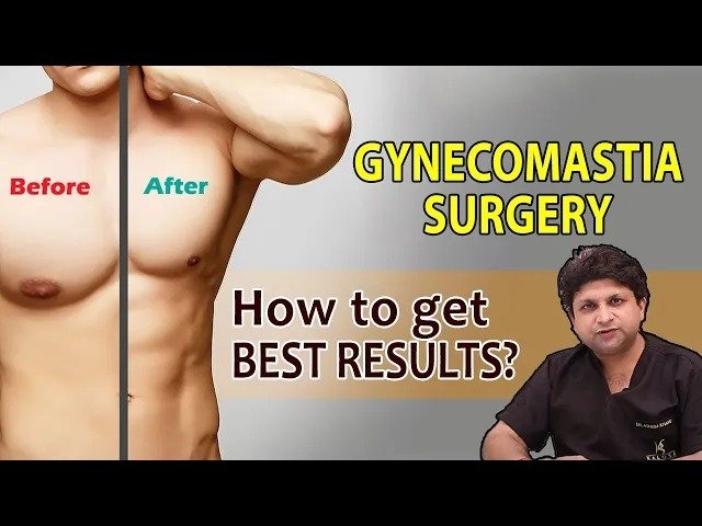 Best Gynecomastia Surgery, Male Breast Reduction Surgeon In India